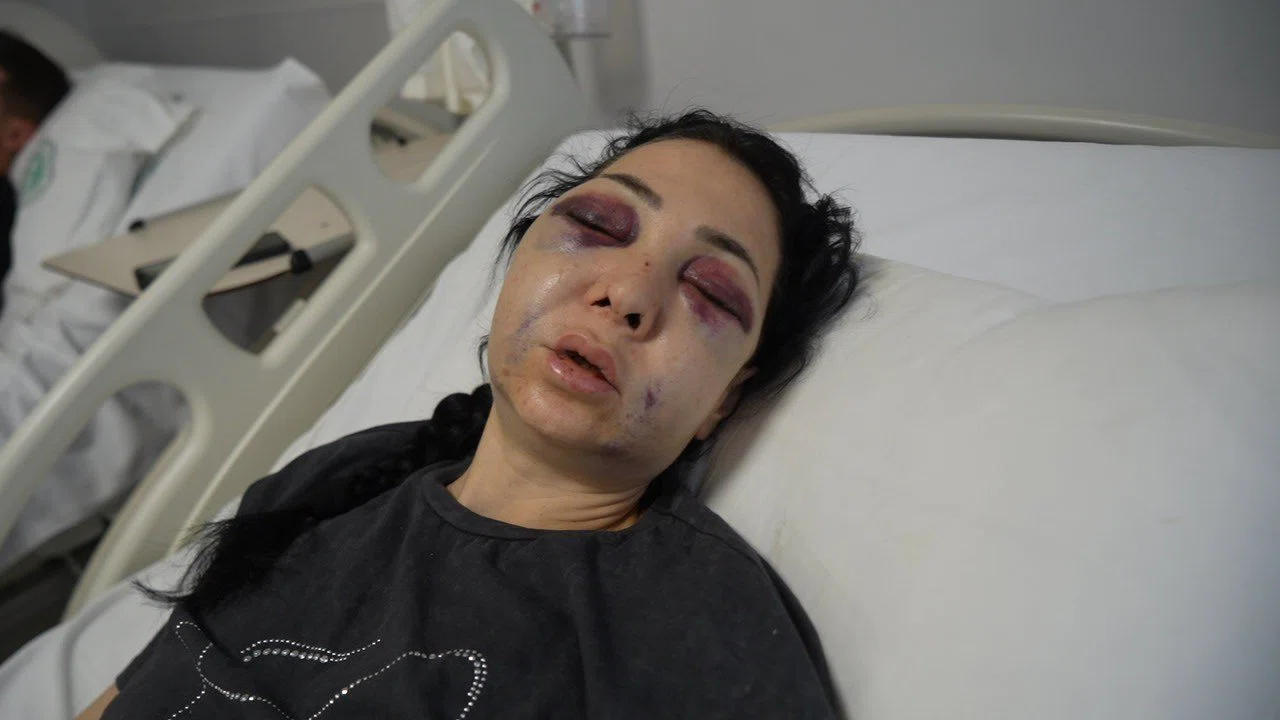 Anne ve oğlunun darp edilmesine ilişkin gözaltına alınan 3 şüpheliden 1’i tutuklandı