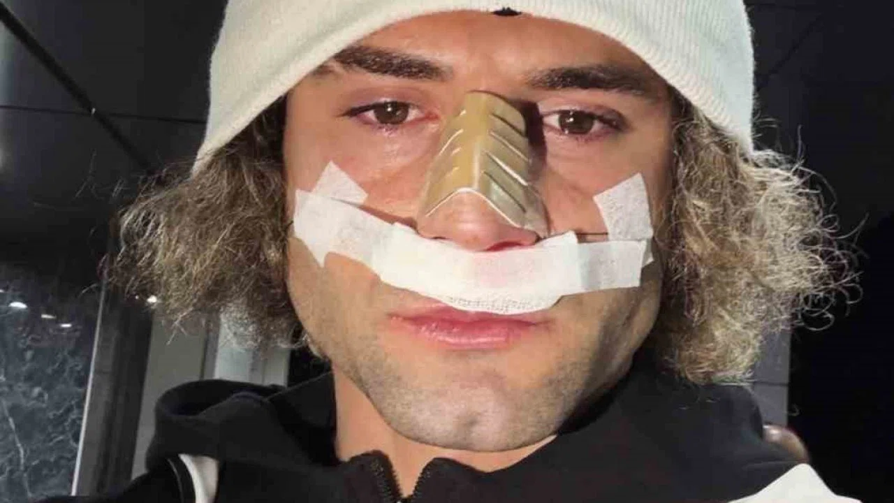 Elazığspor’da Fuat Bavuk’un burnu kırıldı