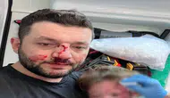 Bebeğinin kafatasını çatlatan komşu için tahliye kararı verildi