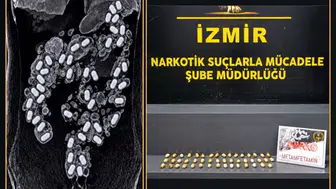 Havalimanında tehlikeli yolculuk: Midesinden 47 kapsül zehir çıktı