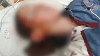 Köpek saldırısı sonrası mahkemeden ağır fatura: Hayvan sahiplerine emsal uyarı