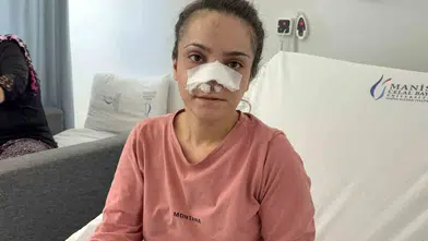 Kabus dolu geceyi anlattı: Eşinin kopardığı burun için mucizevi kurtuluş