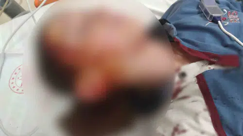 Köpek saldırısı sonrası mahkemeden ağır fatura: Hayvan sahiplerine emsal uyarı