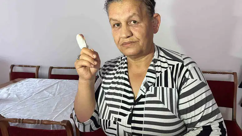 Karşıyaka'da Parmağı Kopan Anne: "O Köpek Bulunmadan Yüzüm Gülmeyecek"
