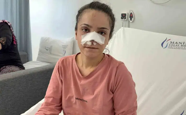 Kabus dolu geceyi anlattı: Eşinin kopardığı burun için mucizevi kurtuluş