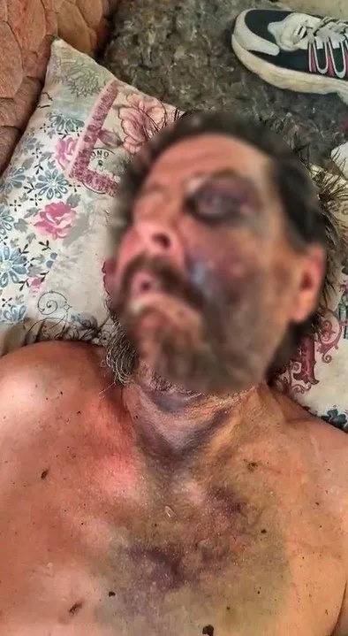 Gümüldür'de dehşet dolu anlar: Saldırıya uğrayan adam harabede ölüme terk edildi