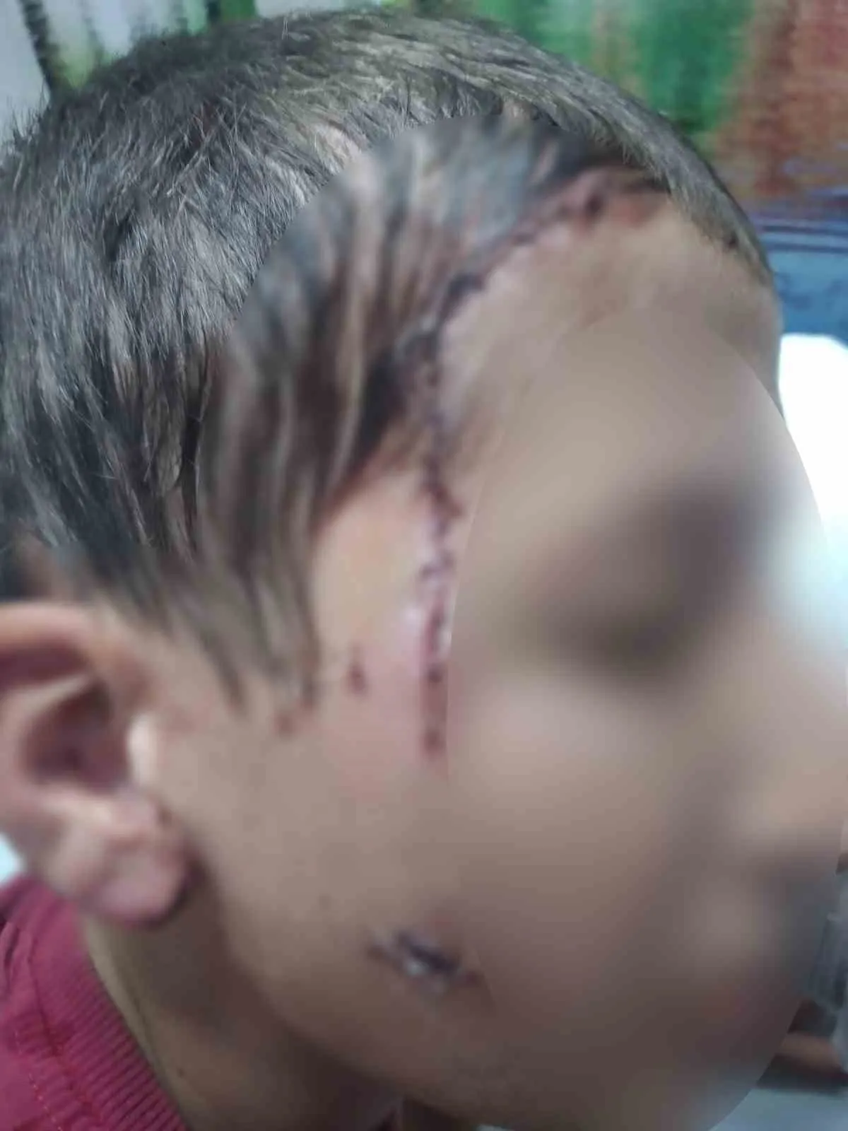 Köpek saldırısı sonrası mahkemeden ağır fatura: Hayvan sahiplerine emsal uyarı